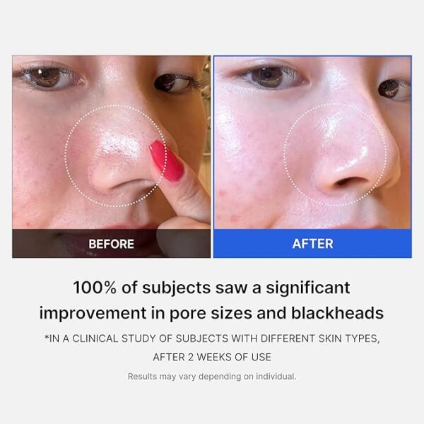 52%Off Limited Time Deal"Textured Facial Toner Pads" - Image 3